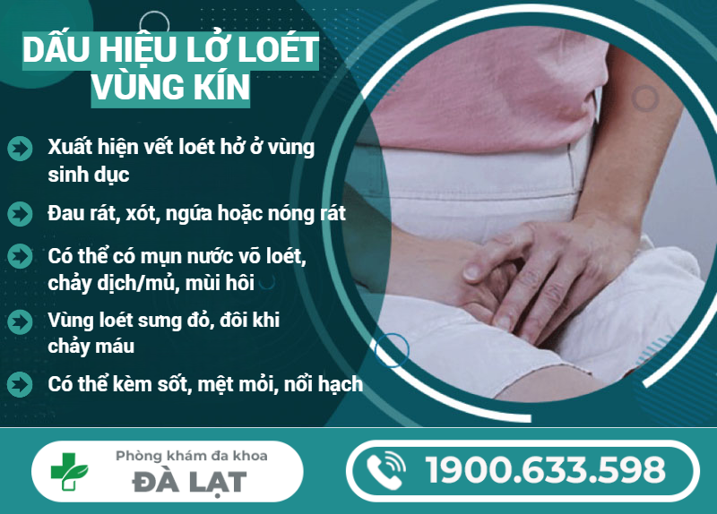 Hình ảnh minh họa